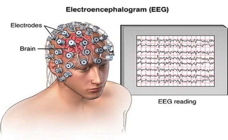 เทคนิคการแพทย์ ม.มหิดล แนะป้องกันระเบิดเวลาทางใจ ใช้เครื่อง EEG ตรวจคลื่นความคิด ความเครียด ความกดดัน