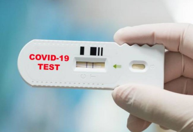 ตรวจ covid-19 ปุ๊บ รู้ปั๊บ !  สาธารณสุขชี้โฆษณาโอ้อวดเกินจริง รู้ผลแค่พริบตา 10 นาที อย.เข้ม ห้ามร้านขายยา วางขายเด็ดขาด อนุญาตให้เฉพาะแพทย์ตรวจตามมาตรฐานเท่านั้น